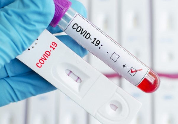 1033 нови случая на коронавирус у нас са регистрирани за